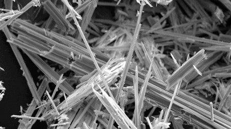 Image: Magnified Asbestos fibres